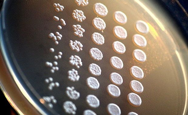 Yeast cells grow into colonies in a Petri dish.