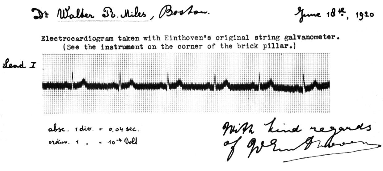 Early Einthoven Electrocardiogram, 1903