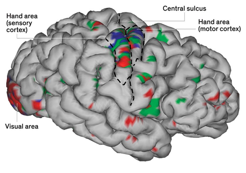 Image of a brain with callouts. 