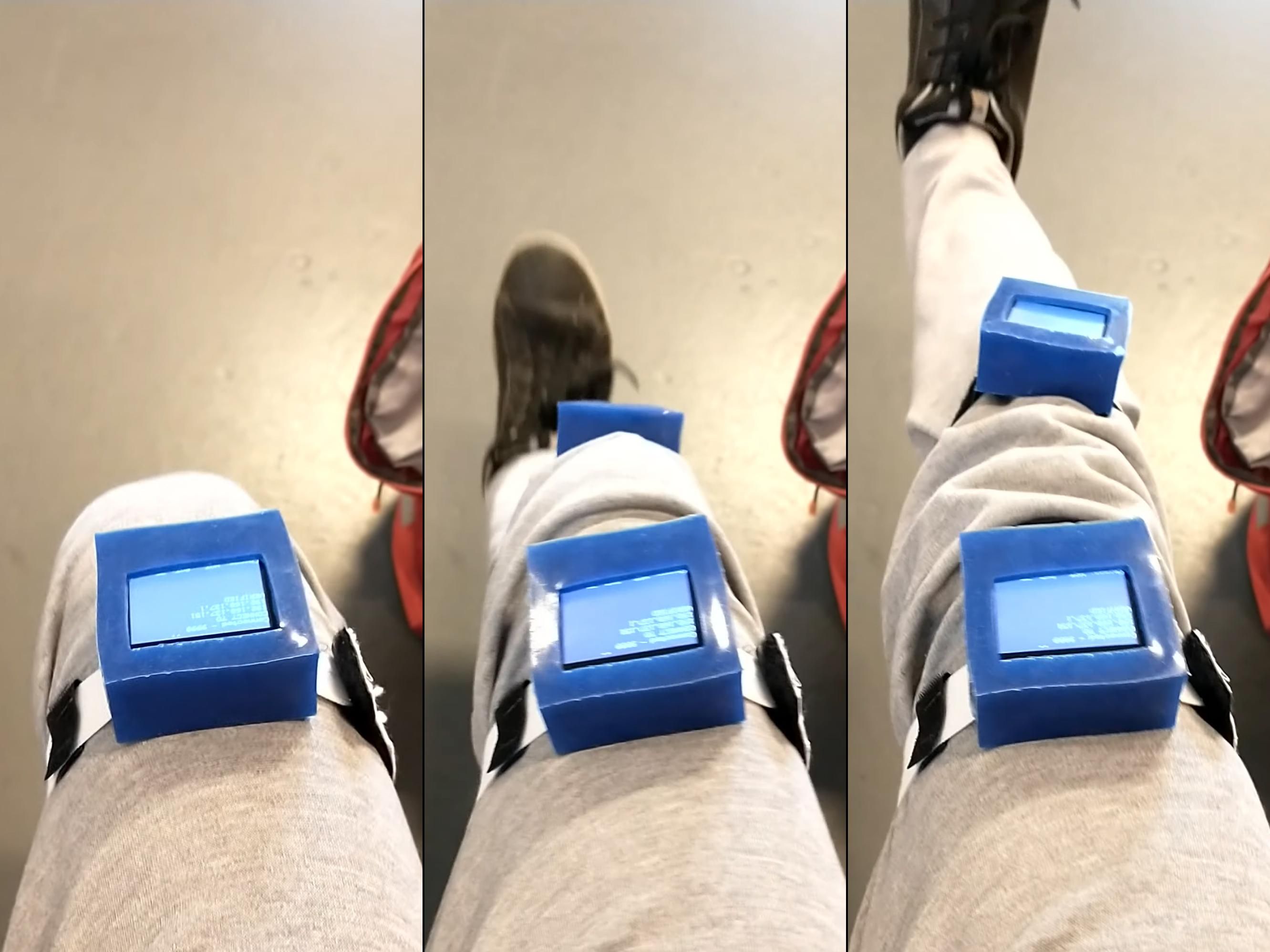 3 images showing blue box contraptions on a leg. The leg starts bent, and then is shown half and fully straightened.