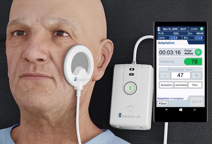 3D rendering of a man with a circular device against his cheek, linked to a rectangular box labelled BrainsGate ISS. A phone shows a screen with activity numbers for pulse and stimulation.
