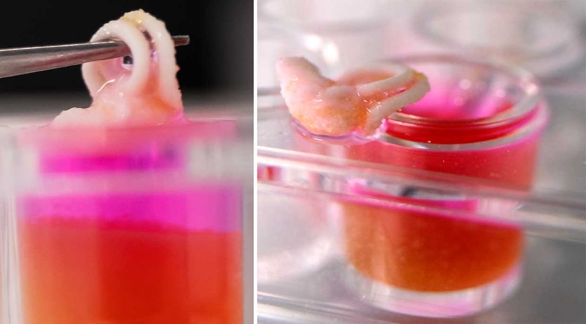 A 3D printed human inner ear structure made with the CORBICS technique