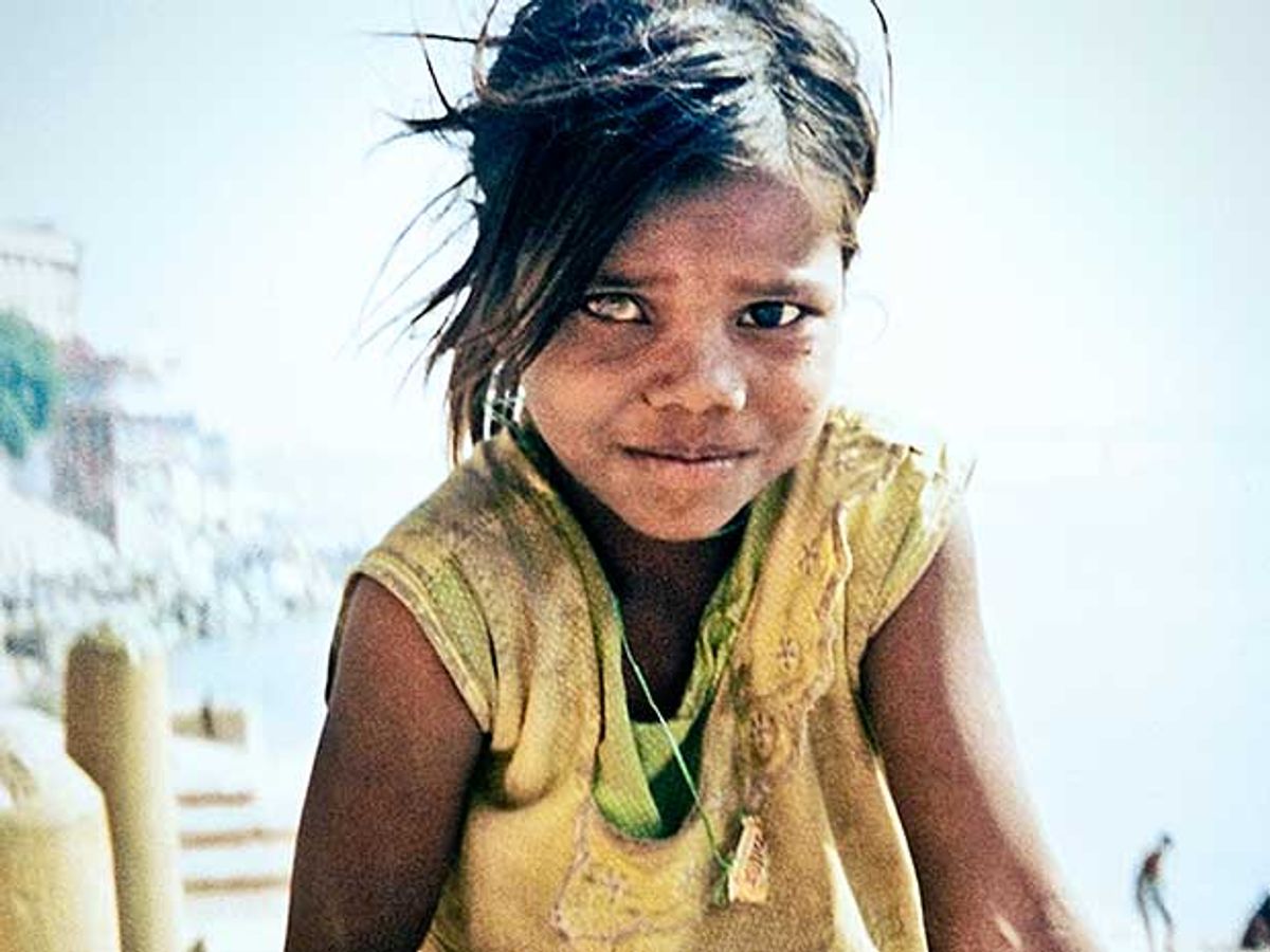 A child with cataracts