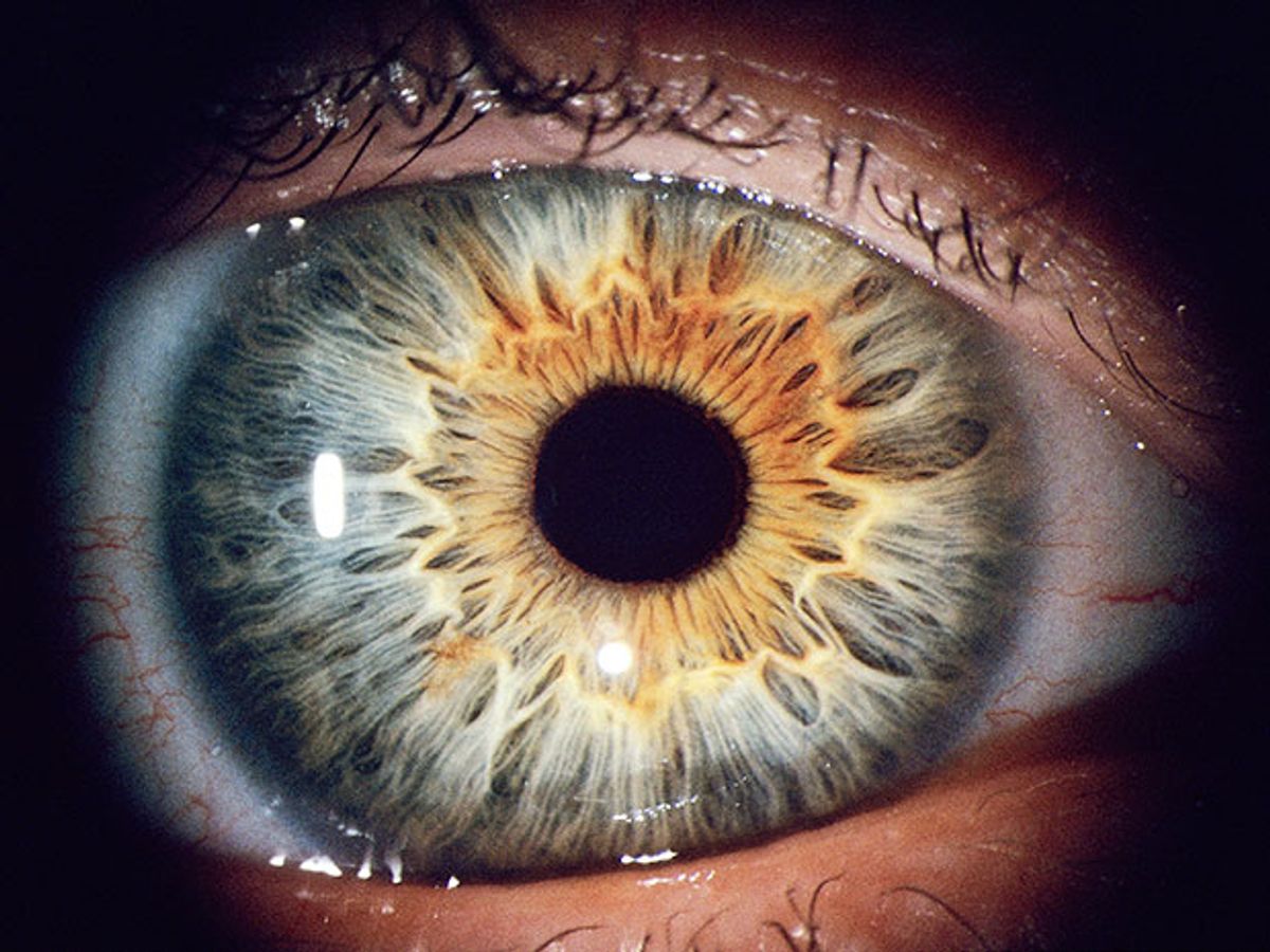 A close-up photograph of an eye, showing the tiny muscle fibers that compose the iris.
