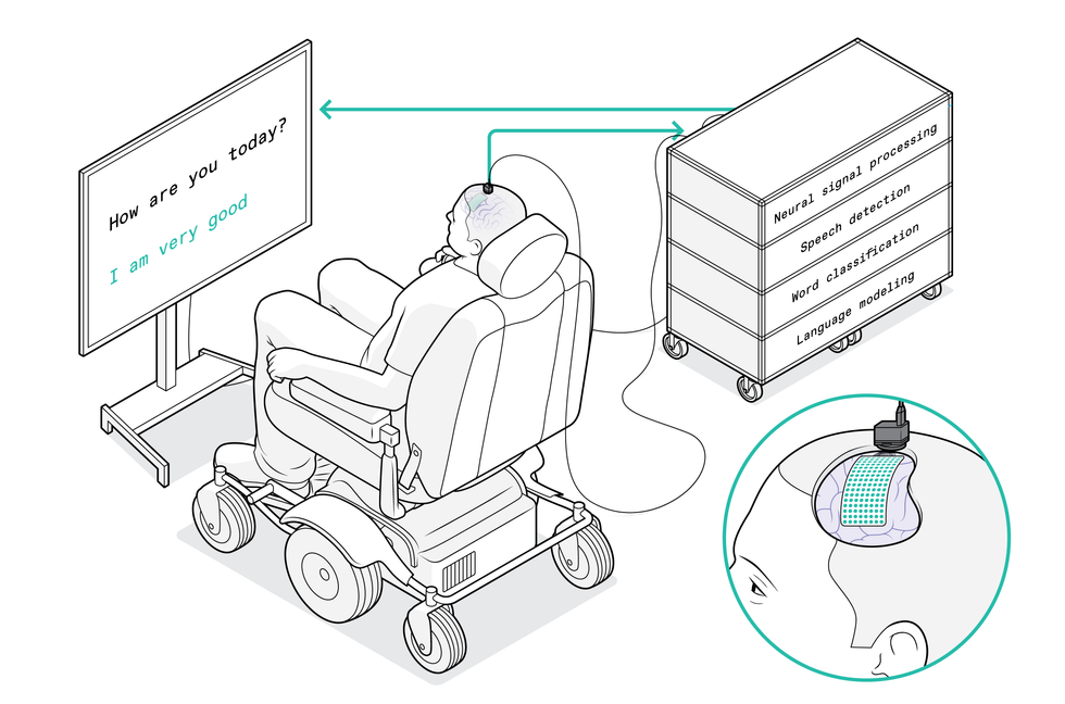 A diagram shows a man in a wheelchair facing a screen that displays two lines of dialogue: \u201cHow are you today?\u201d and \u201cI am very good.\u201d Wires connect a piece of hardware on top of the man\u2019s head to a computer system, and also connect the computer system to the display screen. A close-up of the man\u2019s head shows a strip of electrodes on his brain.