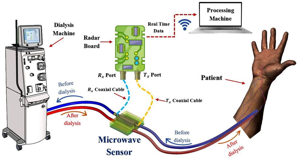 A diagram shows the sensor's location between the dialysis machine and patient.