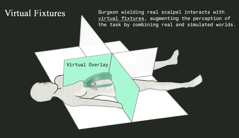 A drawing of a person lying flat on a white surface, with green and white panels crisscrossing the body.
