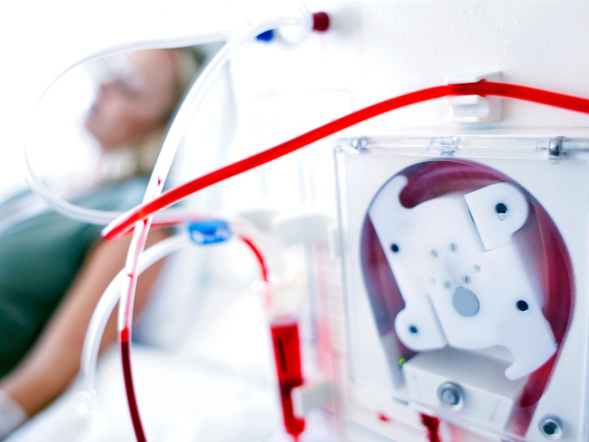 A hemodialysis machine is seen in the foreground. A patient, blurred, is in the background.