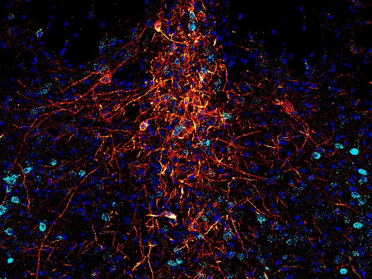 A new, non-invasive technique turned on these brain cells (serotonergic dorsal raphe cells) with millisecond-precision