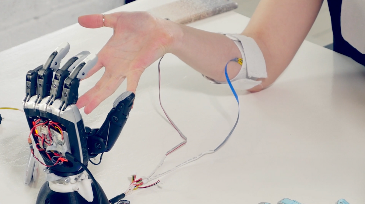 A person with sensors attached to their arm controls a robotic hand