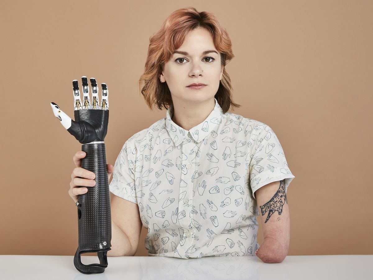 A photograph of a young woman with brown eyes and neck length hair dyed rose gold sits at a white table. In one hand she holds a carbon fiber robotic arm and hand. Her other arm ends near her elbow. Her short sleeve shirt has a pattern on it of illustrated hands.