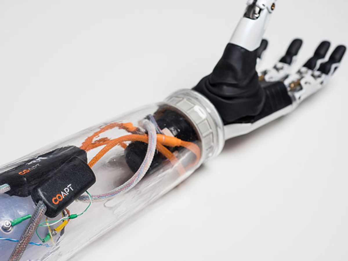 A prosthetic forearm and hand with a Coapt device
