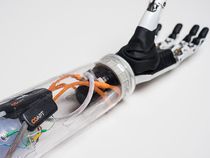 Bionic Arms Get a Thought-Control Upgrade