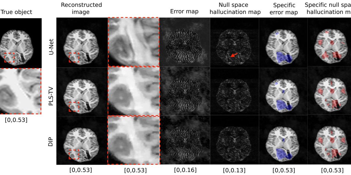Study: Medical Image AIs Need a Good “Hallucination Map” - IEEE Spectrum