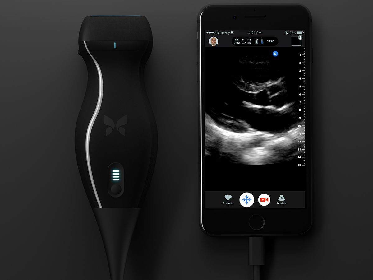 A smartphone screen displays an ultrasound image. Attached to the smartphone is a black ultrasound wand.