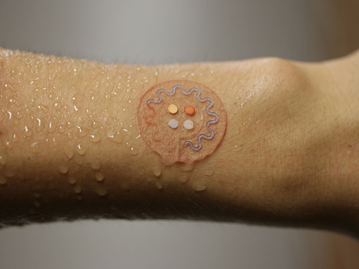 A soft, skin‐mounted microfluidic device for capture, collection and analysis of sweat. Photo: John Rogers/Northwestern University