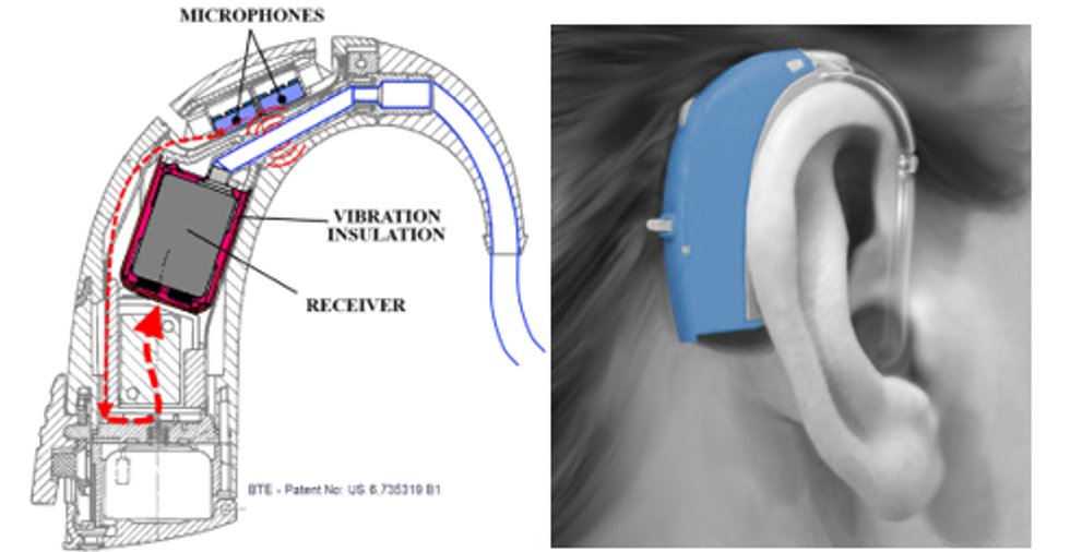 A typical BTE hearing aid includes microphones, vibration insulation, and a receiver, among other components. The tight spacing of these components invites troublesome acoustic and mechanical feedback. (Image credit: Knowles Corp.)