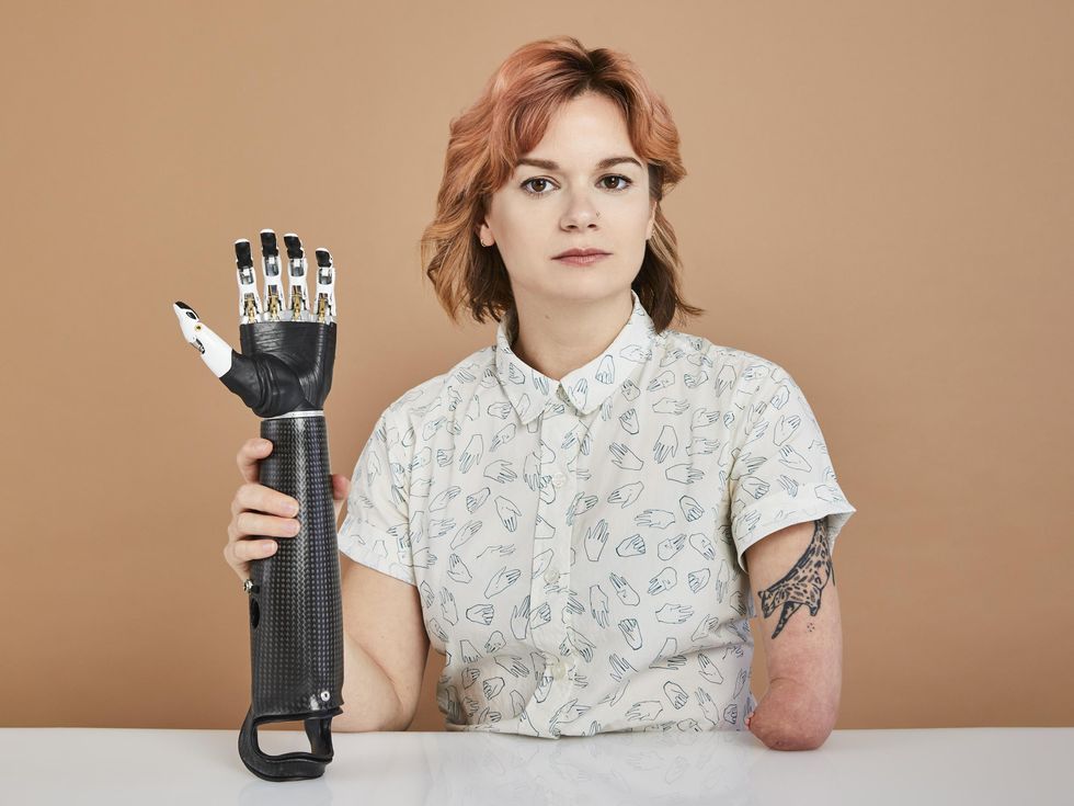 A young woman with brown eyes and neck length hair dyed rose gold sits at a white table. In one hand she holds a carbon fiber robotic arm and hand. Her other arm ends near her elbow. Her short sleeve shirt has a pattern on it of illustrated hands.