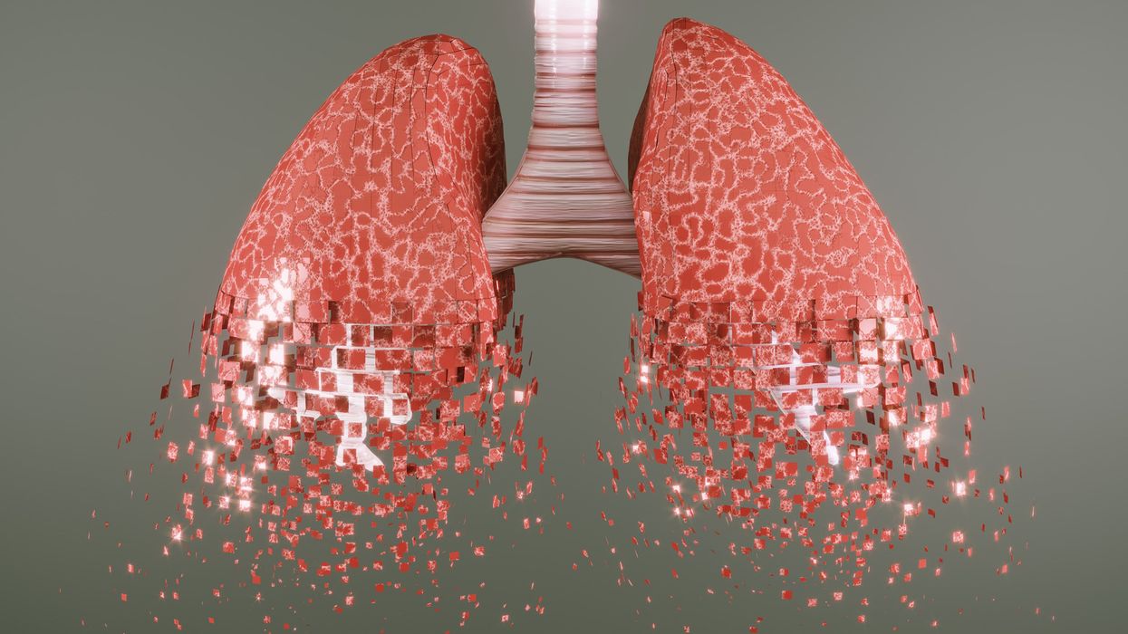abstract-image-of-lungs-breaking-up-at-t