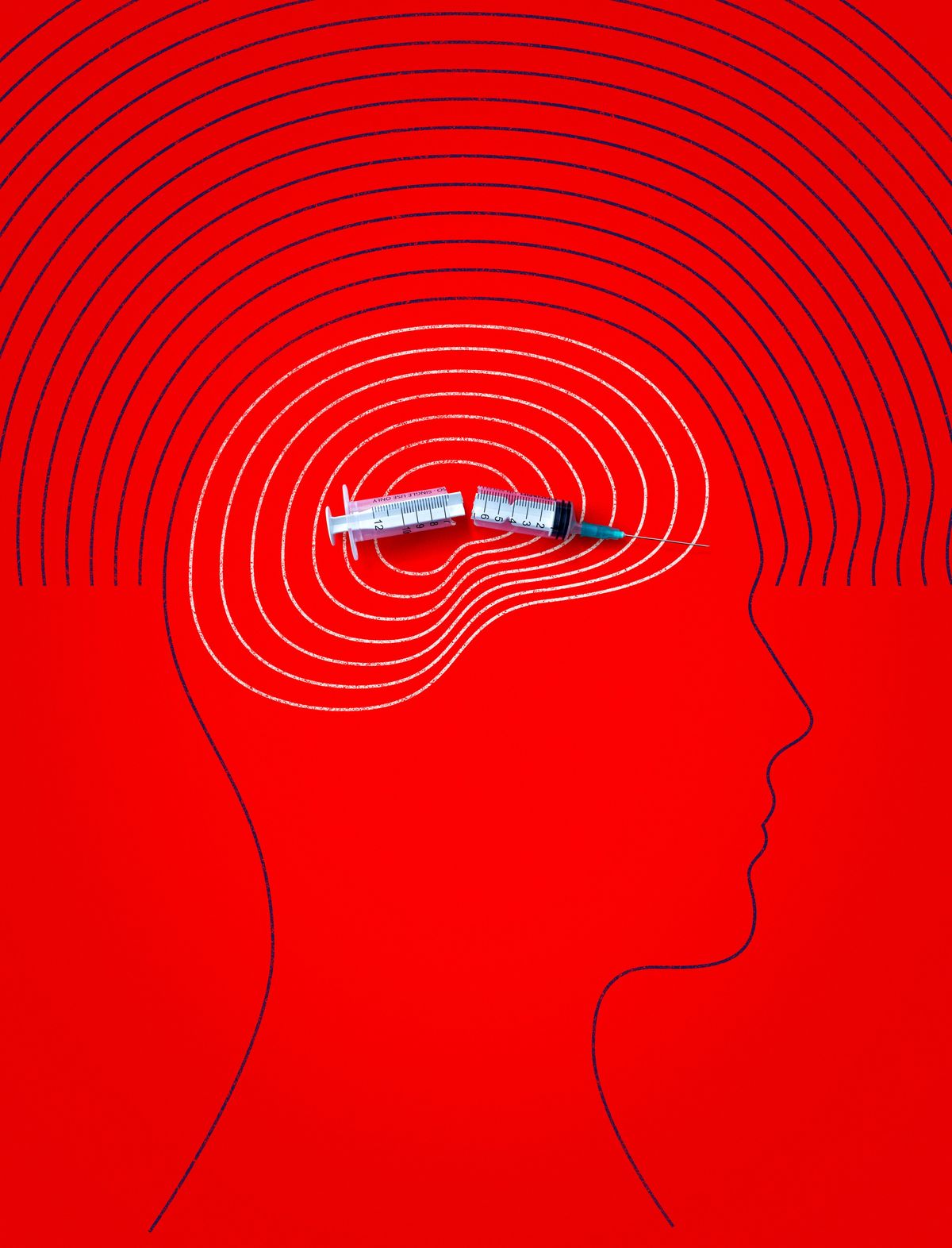 An illustration of person's head with a broken hypodermic needle.   