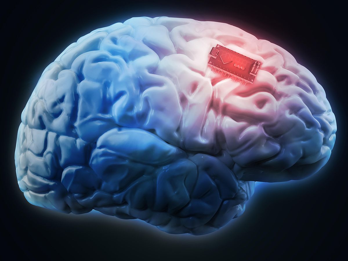 An illustration shows a human brain with a glowing chip on its surface.