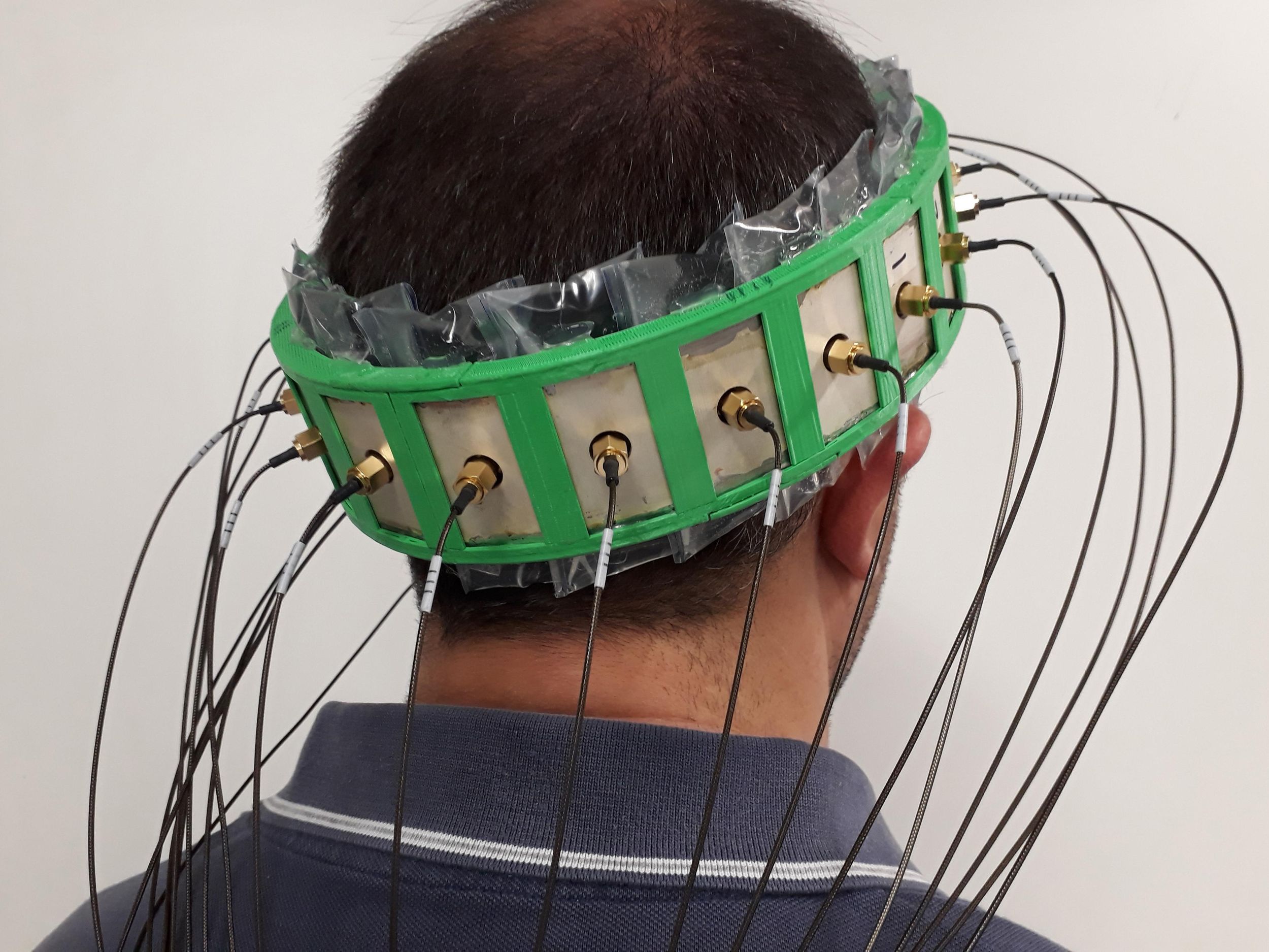 Back view of a man's head. A large green object encircles it, with wires coming out of white rectangular shapes across the surface. 