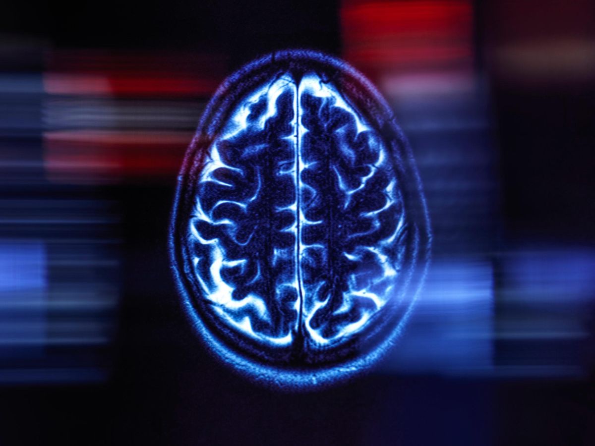 blue brain scan on a black background