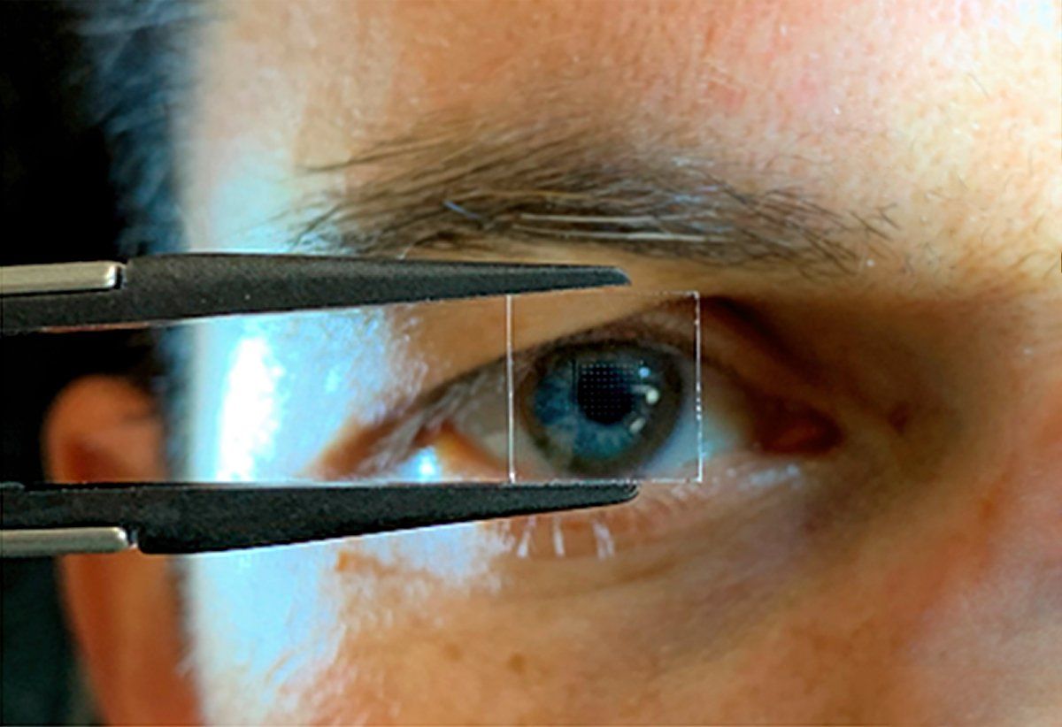 Close-up of a man's eye holding tweezers with a semitransparent square of material in front of it.