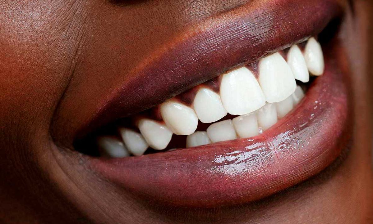 Close up of a woman's teeth