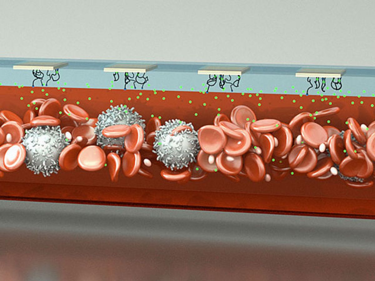 Concept art of the MEDIC device shows a stream of blood serum particles passing through the microfluidic chamber’s aptamer filters (credit: UC Santa Barbara)