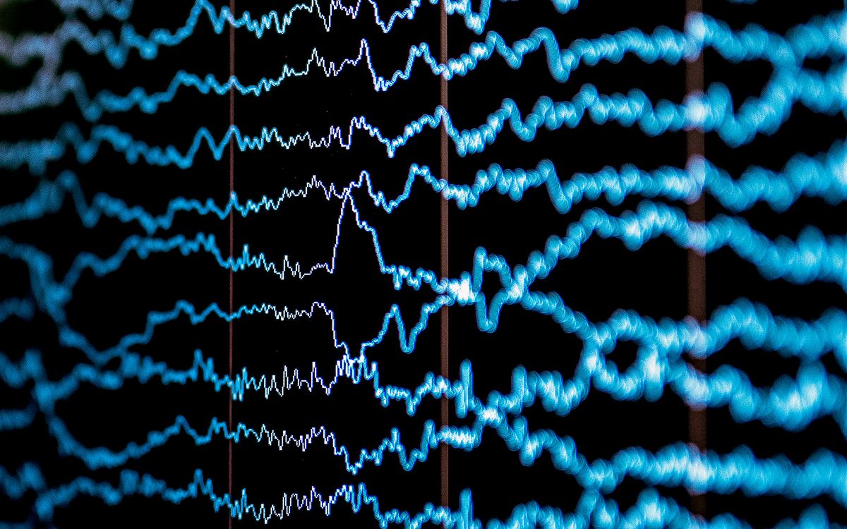 Digital display showing electrical activity in the brain from a electroencephalogram test.