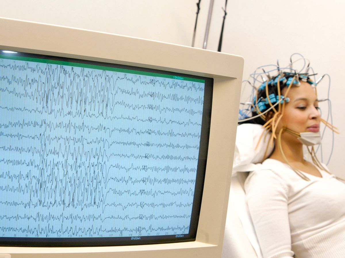Electroencephalogram (EEG) on a 27-year old woman. Epilepsy tracing on the screen.