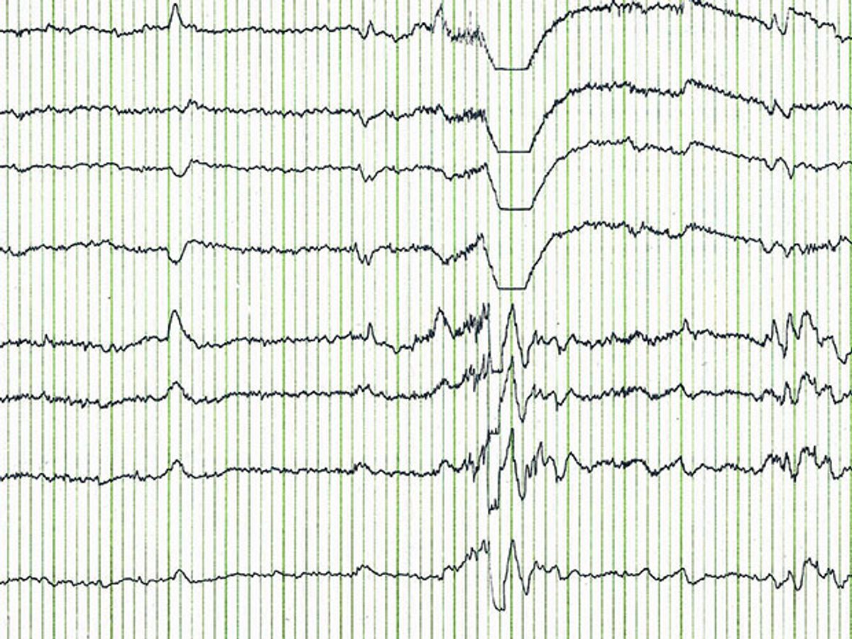 Electroencephalography (EEG) traces