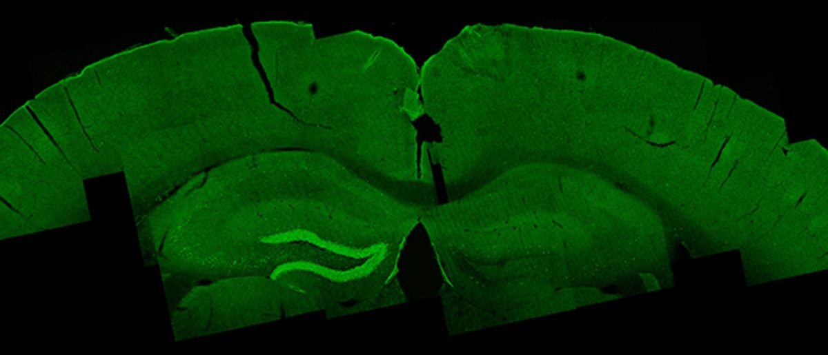 Green photo of brain cross-section