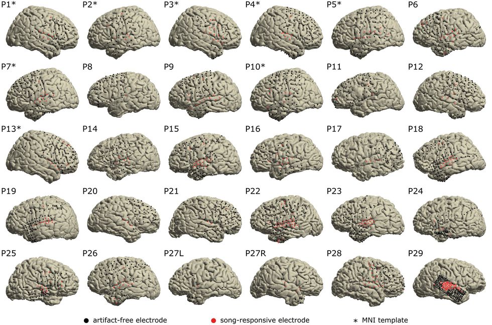 Illustration of 29 brains with black and red dots on their surfaces