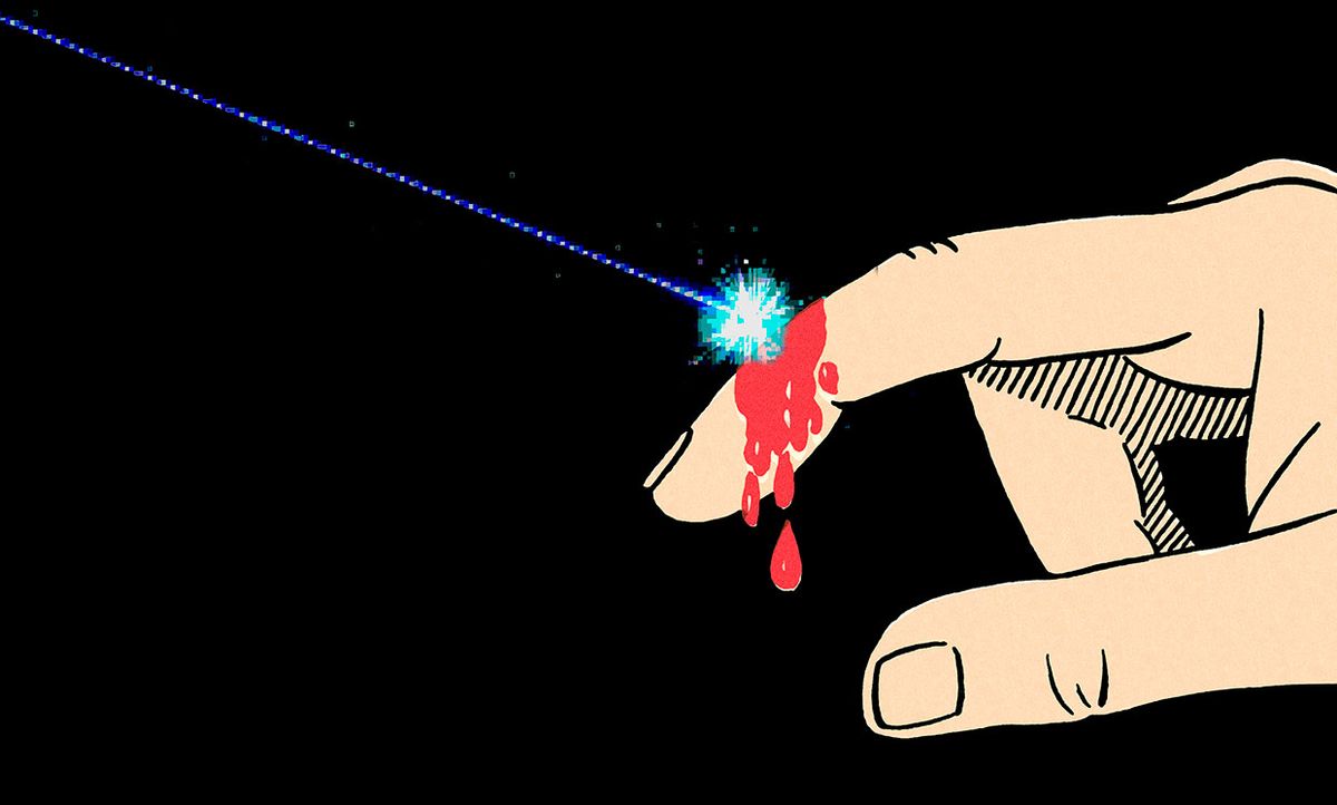 Illustration of a laser healing a cut on a finger
