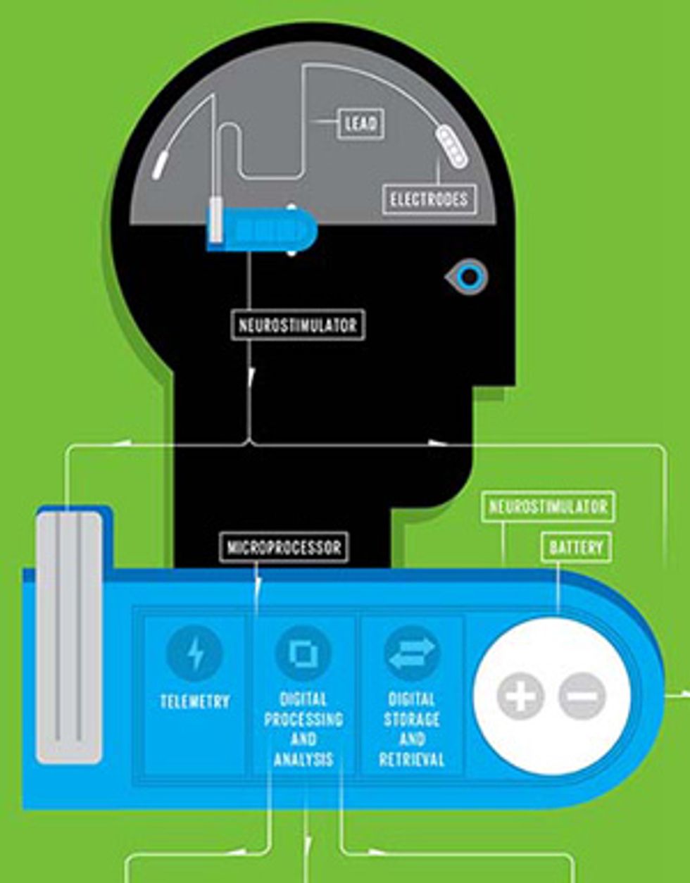 illustration of brain scan for seizure