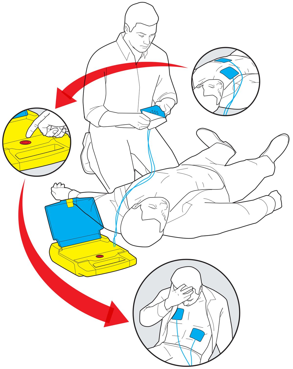 Illustration of defibrillator process