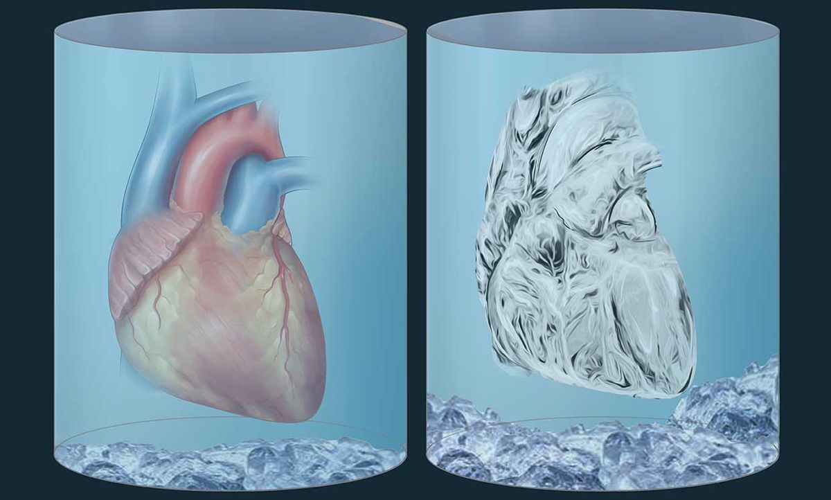 Illustration of two hearts, one prepared for neonatal organ cryopreservation