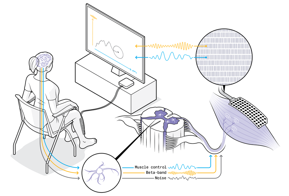 Illustration showing an experimental setup to study neural control. A user looks at a computer monitor that is connected to the electrode array on her shin.