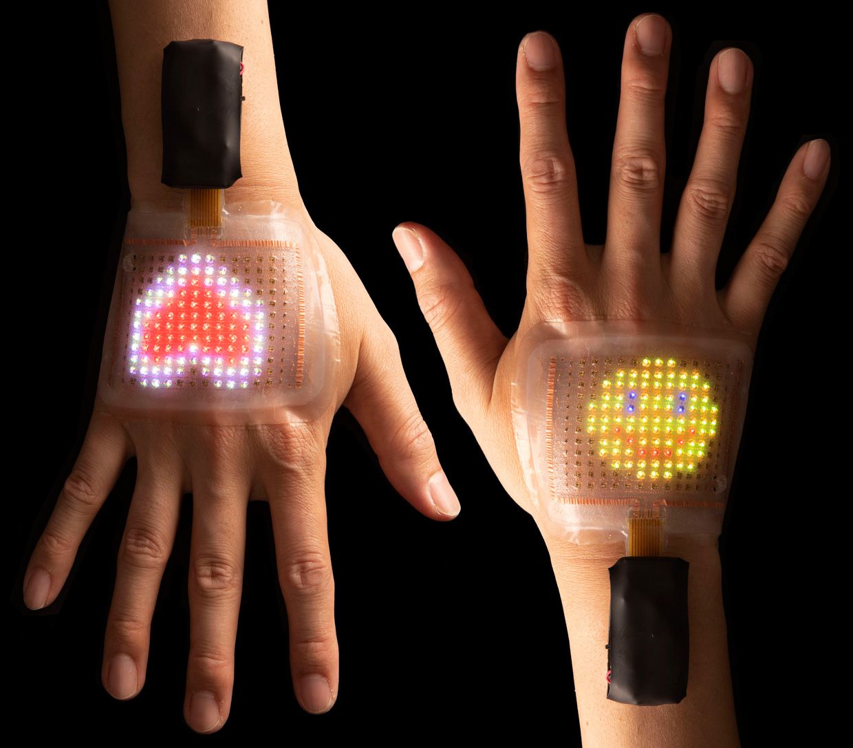 Image of two hands displaying the skin displays.
