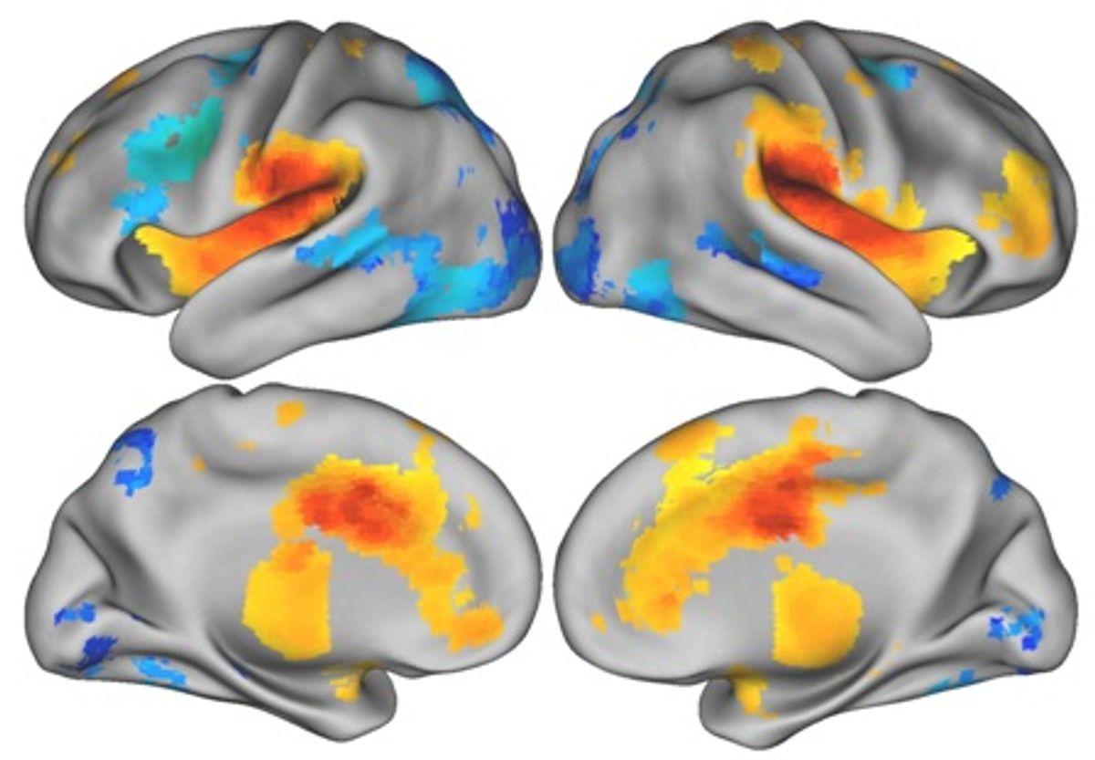 A Better Way to Sort fMRI Data