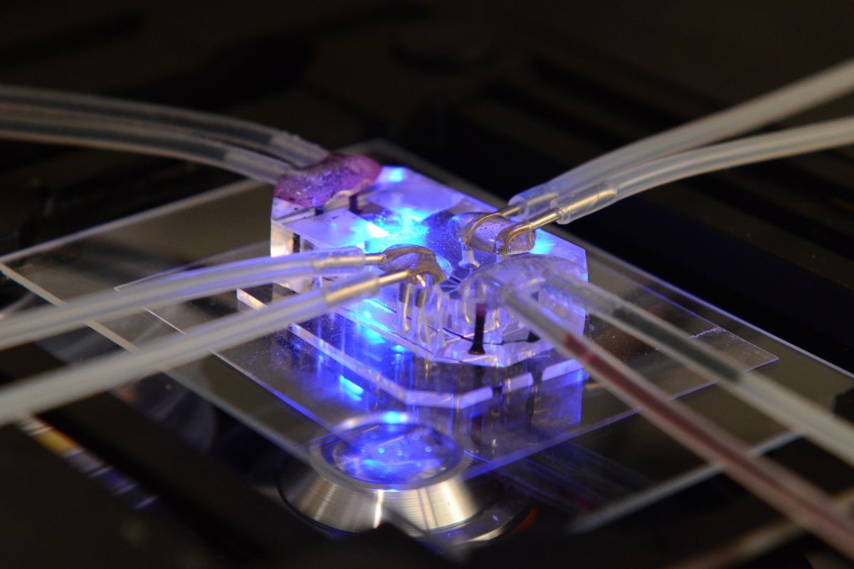 Lung-on-a-Chip Used to Model Human Disease