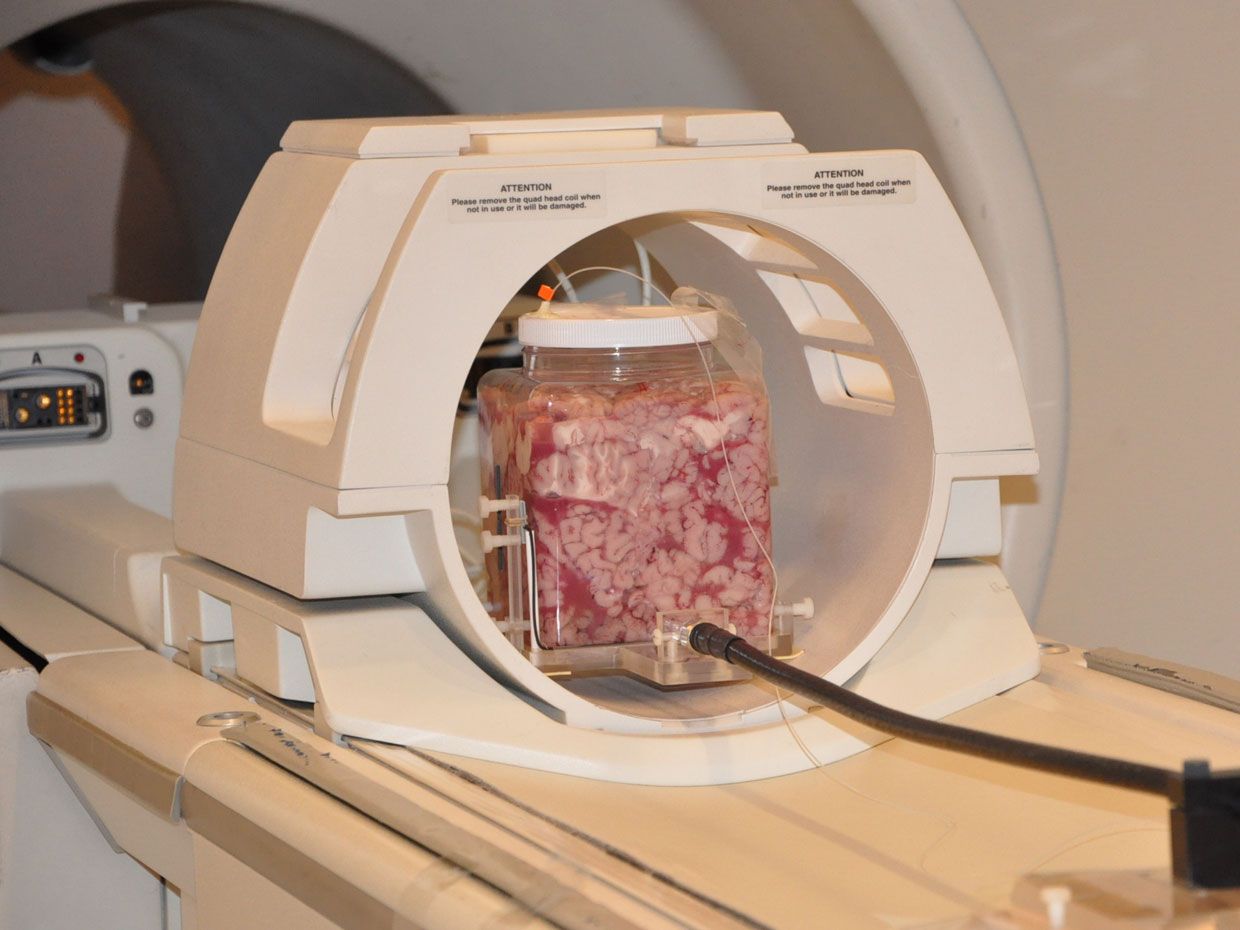 jarred cow brains used to test whether MRI scans can map the heat generated by cellphone radiation