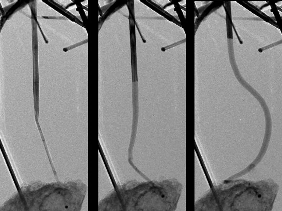Band-Gap Engineering of Nanowires Could Boost Batteries
