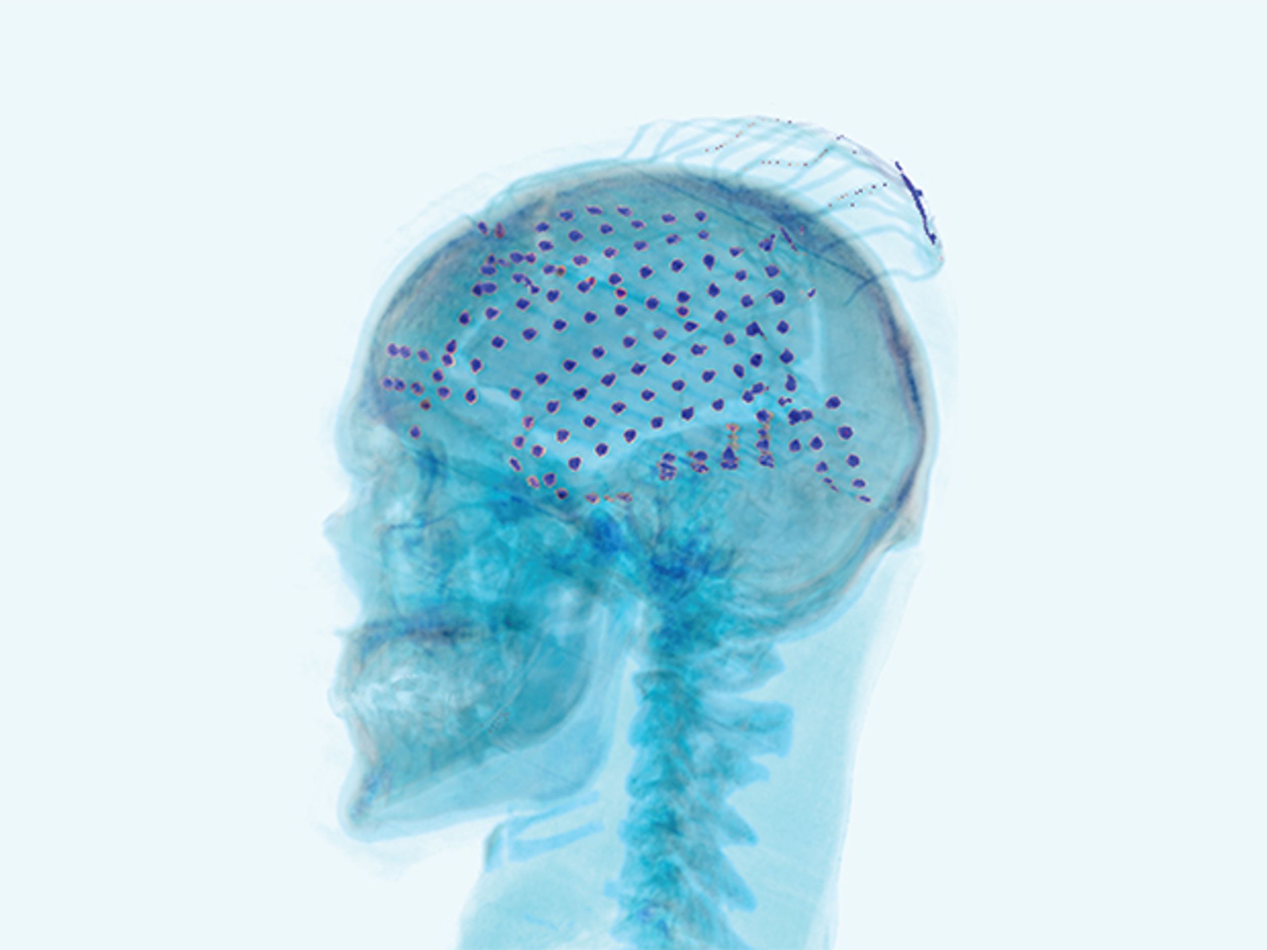 How to Catch Brain Waves in a Net