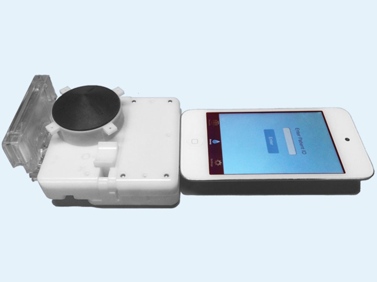 $34 Diagnostic Tool for STDs Plugs into Smartphone, Rivals $18,000 Lab Equipment
