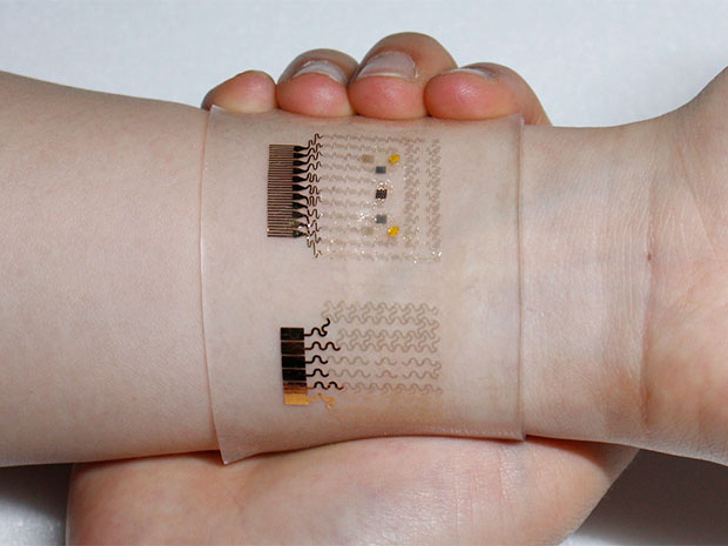 Graphene Wristband Senses Your Blood Sugar—and Treats It