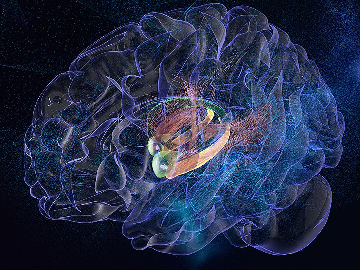 Medical illustration representing activation of the amygdala in the brain.