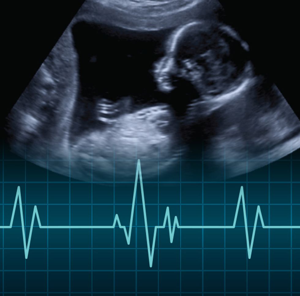Stevens Engineers Design Fetal Heart Monitor That Could Detect Early Signs  of Pregnancy Complications - IEEE Spectrum